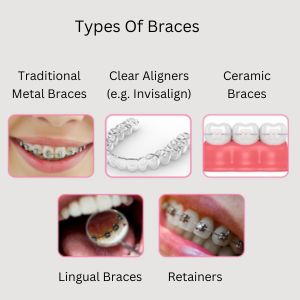 Orthodontics in Gurgaon