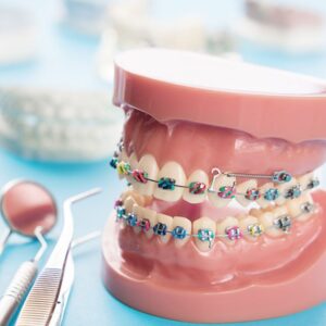 ORTHODONTICS