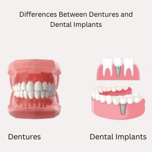 Dental Implants in Gurgaon