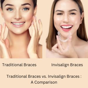 Traditional Braces and Invisalign