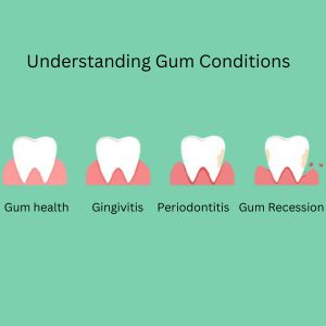 Gum Treatment in Gurgaon