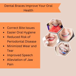 Dental Braces in Gurgaon