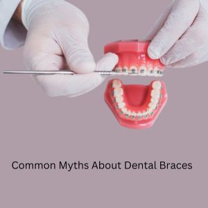 Common myths about dental braces and the truth for better orthodontic care.