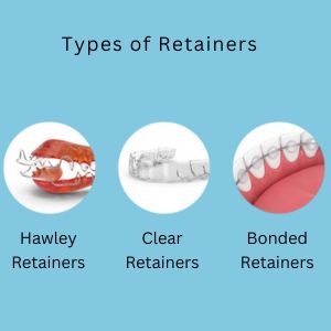 Types of Retainers