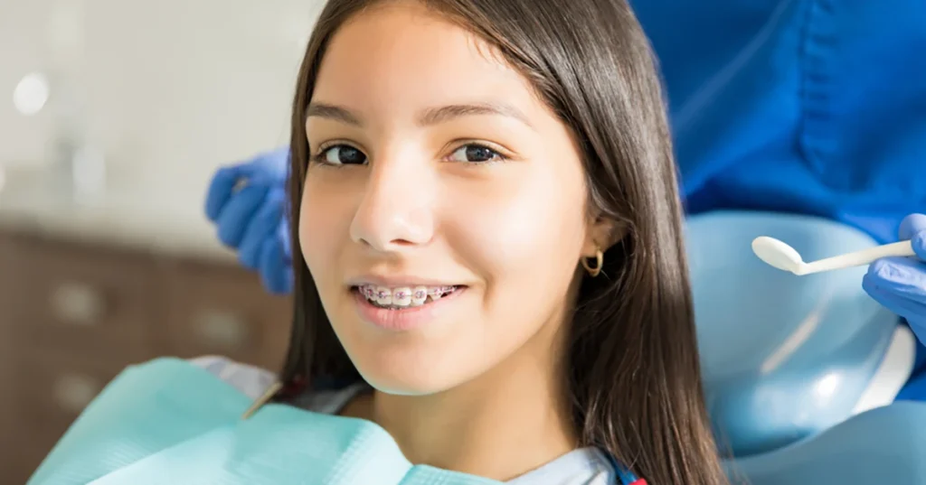 What are dental braces