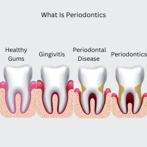 Best Dental Clinic in Gurgaon: Periodontics in Gurgaon.