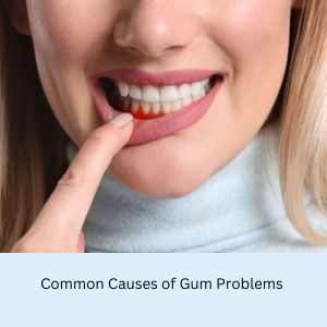 Periodontics For Gum Problems in Gurgaon