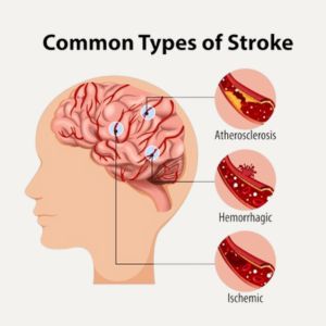 Periodontics and Systemic Diseases