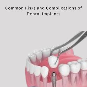 Top 10 dentist in Gurgaon: Dental Implant in Gurgaon