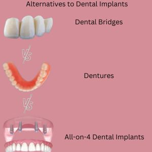 Dental Implants in Gurgaon: Alternatives to Dental Implants