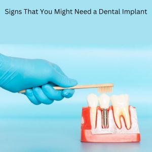 Signs Need a Dental Implant : Dental Implants in Gurgaon