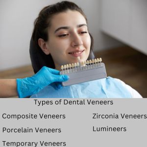 Dental Veneers in Gurgaon