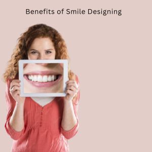 Smile Designing in Gurgaon: Benefits of Smile Designing