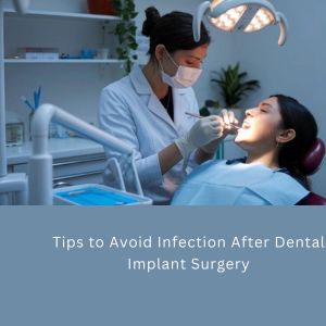 Dental Implants in Gurgaon: Avoid Infection After Dental Implant Surgery