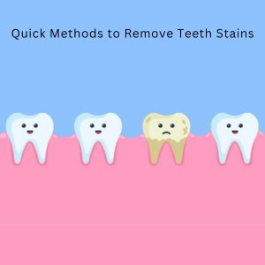 Teeth Whitening in Gurgaon: Remove Teeth Stains