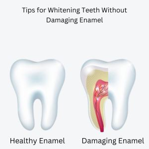 Teeth Whitening in Gurgaon ; Damaging Enamel