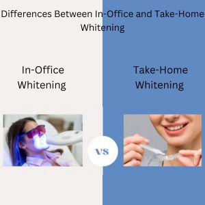 In-Office and Take-Home Whitening