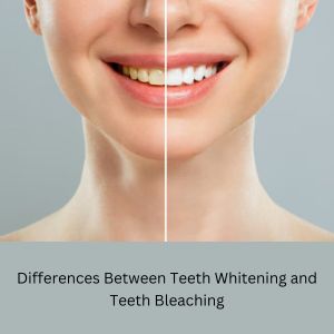 Best Dental Clinic in Gurgaon: Teeth Whitening and Teeth Bleaching