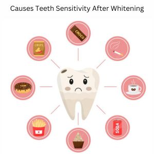 Teeth Sensitivity After Whitening