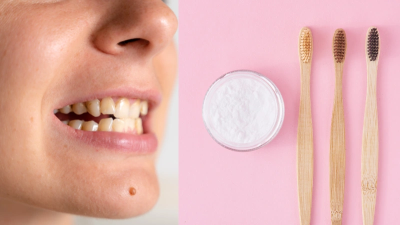 how to remove stains from teeth quickly featured image