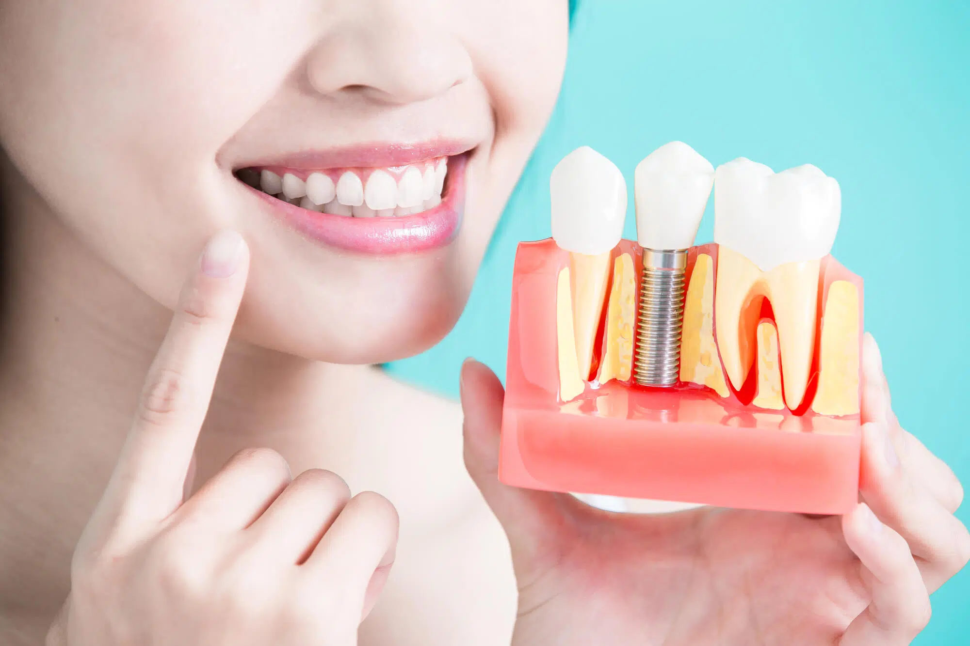 best dental implant surgery in Gurgaon
