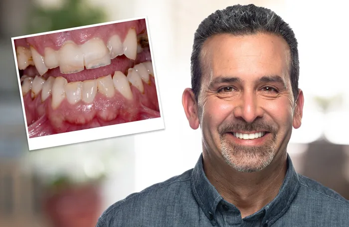 Smile Designing In Gurgaon