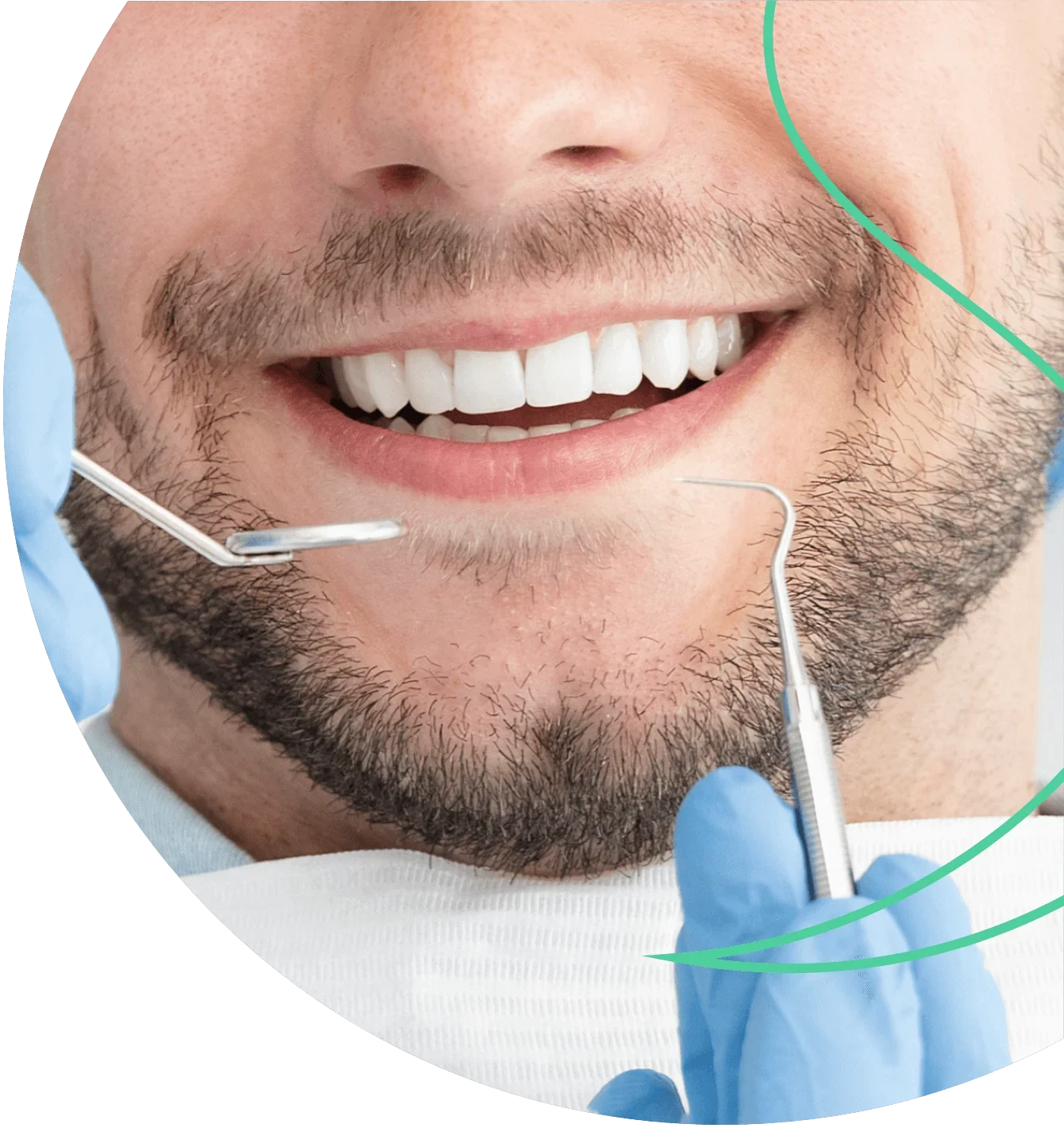 Final Results Of Dental Implants