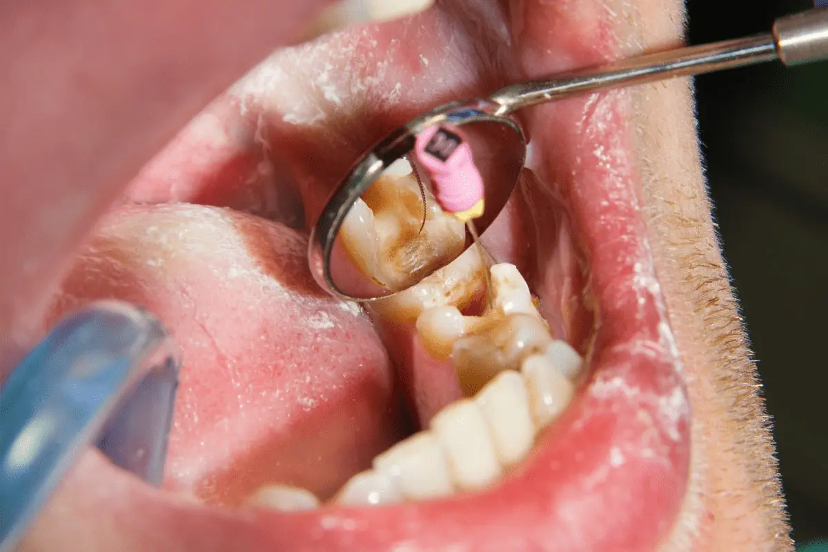 Top Dental Services In Gurgaon Sec 57