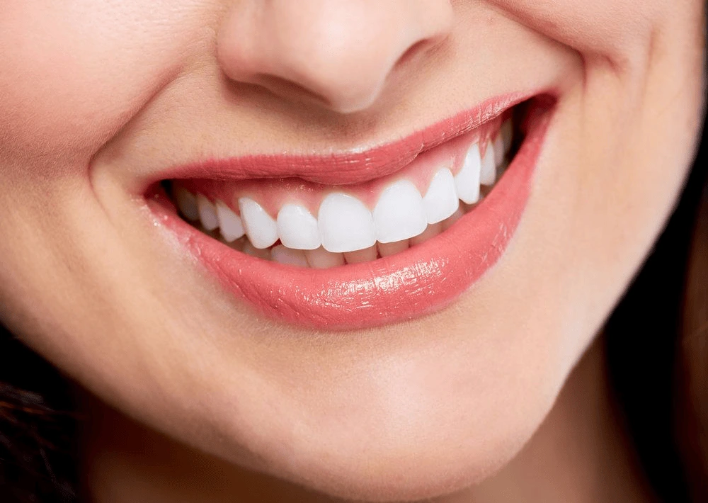 smile makeover in Gurgaon Sec 57
